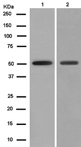 Western blot - Anti-Seladin 1 antibody [EPR10743] (AB181062)