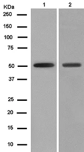 Western blot - Anti-Seladin 1 antibody [EPR10743] (AB181062)