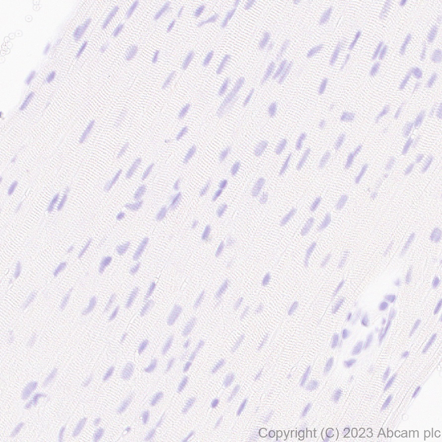 Immunohistochemistry (Formalin/PFA-fixed paraffin-embedded sections) - Anti-Seladin 1 antibody [EPR26466-37] - BSA and Azide free (AB314222), expandable thumbnail