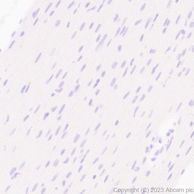 Immunohistochemistry (Formalin/PFA-fixed paraffin-embedded sections) - Anti-Seladin 1 antibody [EPR26466-37] - BSA and Azide free (AB314222)