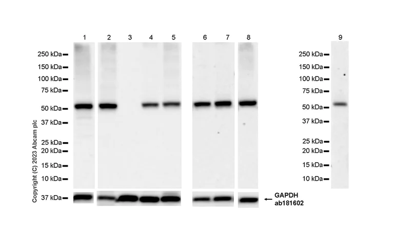 Western blot - Anti-Seladin 1 antibody [EPR26466-37] - BSA and Azide free (AB314222)