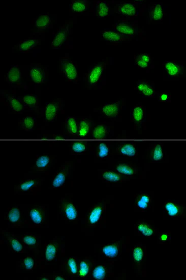 Immunocytochemistry/ Immunofluorescence - Anti-Selenium Binding Protein 1/SBP antibody (AB180782)