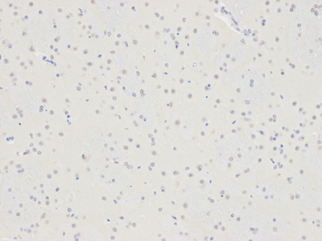 Immunohistochemistry (Formalin/PFA-fixed paraffin-embedded sections) - Anti-Selenium Binding Protein 1/SBP antibody (AB180782), expandable thumbnail
