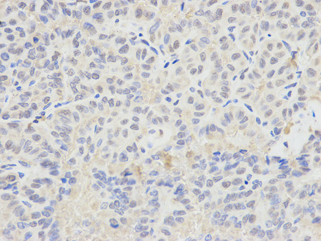Immunohistochemistry (Formalin/PFA-fixed paraffin-embedded sections) - Anti-Selenium Binding Protein 1/SBP antibody (AB180782), expandable thumbnail