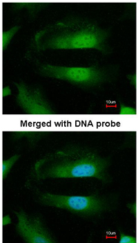 Immunocytochemistry/ Immunofluorescence - Anti-Selenophosphate synthetase 1 antibody (AB96542), expandable thumbnail