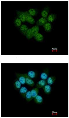 Immunocytochemistry/ Immunofluorescence - Anti-Selenophosphate synthetase 2 antibody (AB153878), expandable thumbnail