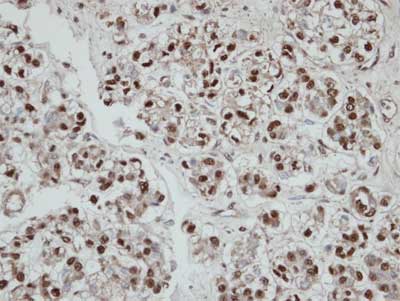 Immunohistochemistry (Formalin/PFA-fixed paraffin-embedded sections) - Anti-Selenophosphate synthetase 2 antibody (AB153878), expandable thumbnail