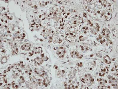 Immunohistochemistry (Formalin/PFA-fixed paraffin-embedded sections) - Anti-Selenophosphate synthetase 2 antibody (AB153878)