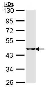 Western blot - Anti-Selenophosphate synthetase 2 antibody (AB153878), expandable thumbnail