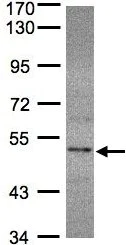 Western blot - Anti-Selenophosphate synthetase 2 antibody (AB96541)