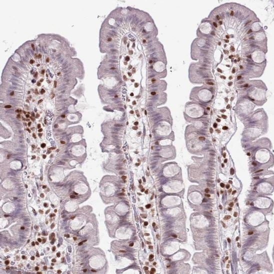 Immunohistochemistry (Formalin/PFA-fixed paraffin-embedded sections) - Anti-SELH antibody (AB151023)