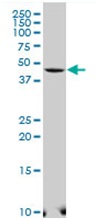 Western blot - Anti-SelI antibody (AB194554)