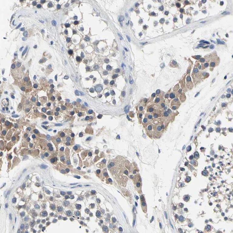 Immunohistochemistry (Formalin/PFA-fixed paraffin-embedded sections) - Anti-SELK antibody (AB121276)