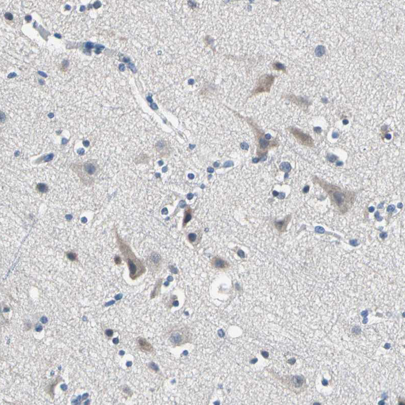 Immunohistochemistry (Formalin/PFA-fixed paraffin-embedded sections) - Anti-SELK antibody (AB121276)