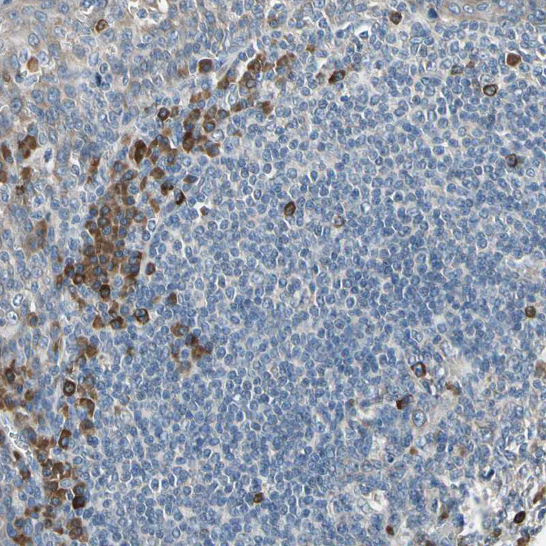 Immunohistochemistry (Formalin/PFA-fixed paraffin-embedded sections) - Anti-SELK antibody (AB121276)
