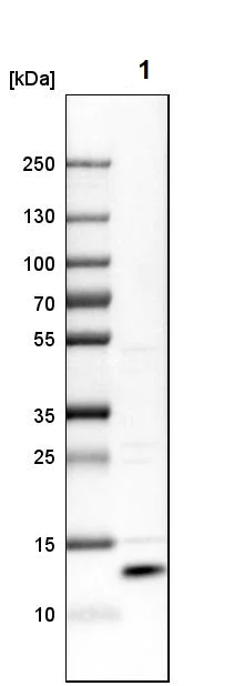 Western blot - Anti-SELK antibody (AB121276)