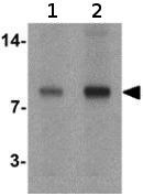 Western blot - Anti-SELK antibody (AB139949), expandable thumbnail