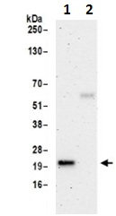 Immunoprecipitation - Anti-SELS antibody (AB190247)