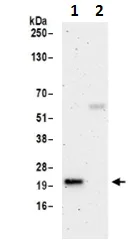 Immunoprecipitation - Anti-SELS antibody (AB190247)