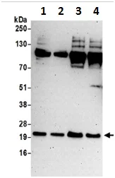 Western blot - Anti-SELS antibody (AB190247)