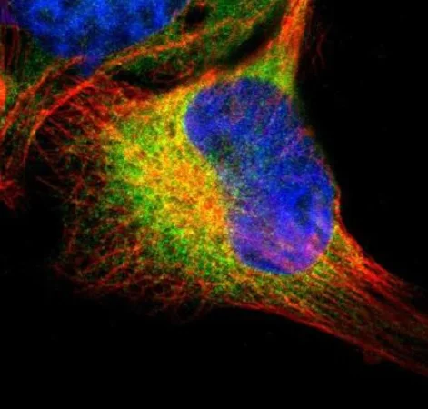Immunocytochemistry/ Immunofluorescence - Anti-SELS antibody (AB223721)