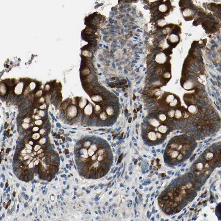 Immunohistochemistry (Formalin/PFA-fixed paraffin-embedded sections) - Anti-SELS antibody (AB223721)
