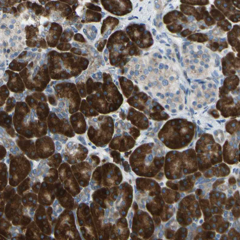 Immunohistochemistry (Formalin/PFA-fixed paraffin-embedded sections) - Anti-SELS antibody (AB223721)