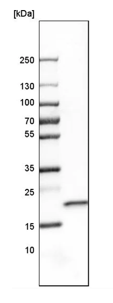 Western blot - Anti-SELS antibody (AB223721)