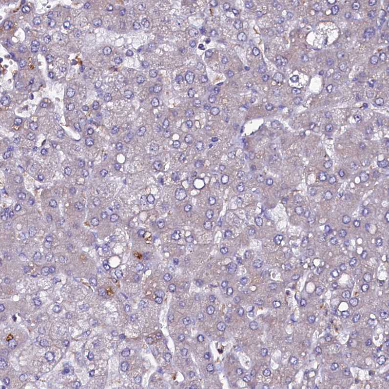 Immunohistochemistry (Formalin/PFA-fixed paraffin-embedded sections) - Anti-SELT antibody (AB122587)