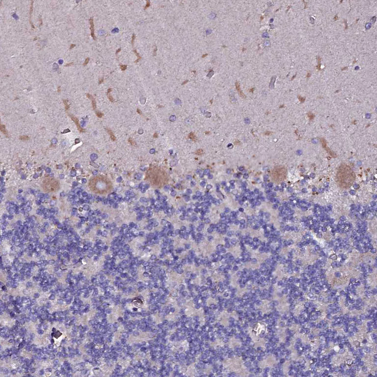 Immunohistochemistry (Formalin/PFA-fixed paraffin-embedded sections) - Anti-SELT antibody (AB122587)