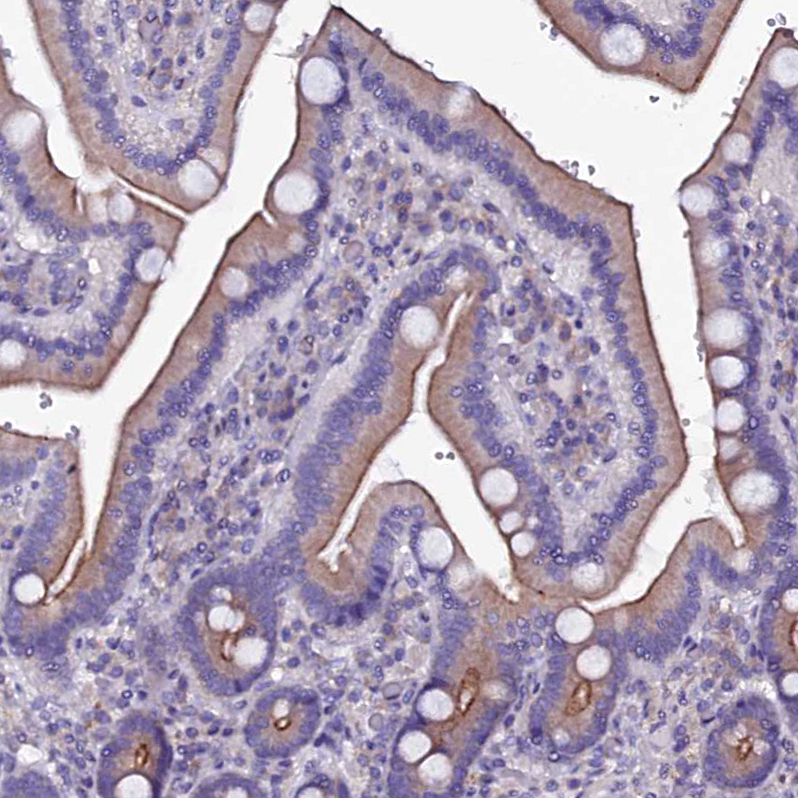 Immunohistochemistry (Formalin/PFA-fixed paraffin-embedded sections) - Anti-SELT antibody (AB122587)