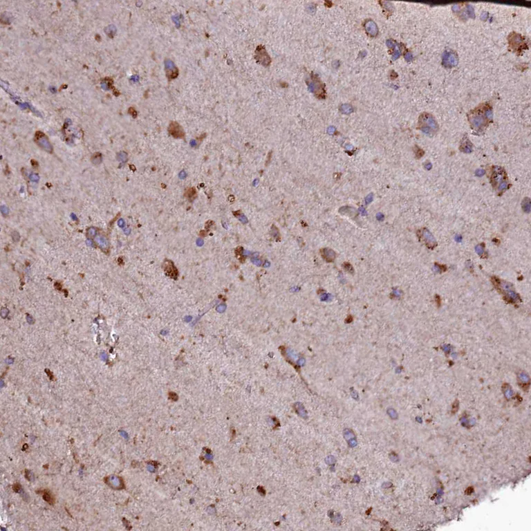 Immunohistochemistry (Formalin/PFA-fixed paraffin-embedded sections) - Anti-SELT antibody (AB122587)