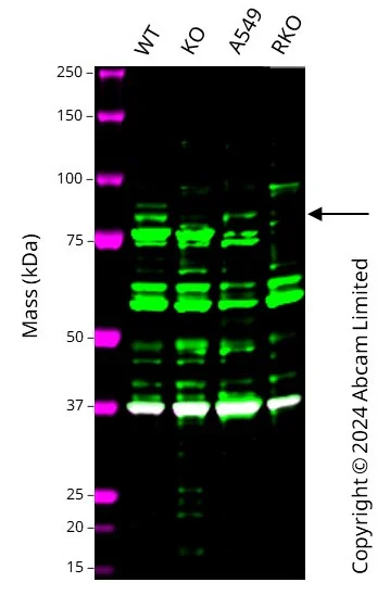 Western blot - Anti-SEMA3B antibody (AB48197)