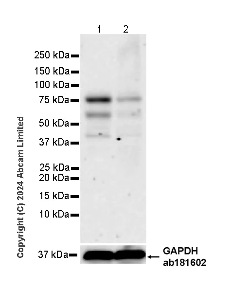 Western blot - Anti-SEMA3B antibody [EPR28920-205] - BSA and Azide free (AB324837)