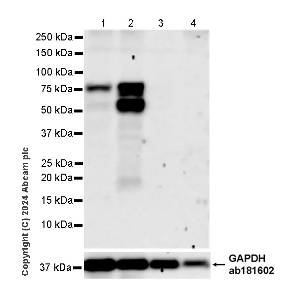 Western blot - Anti-SEMA3B antibody [EPR28920-205] - BSA and Azide free (AB324837)