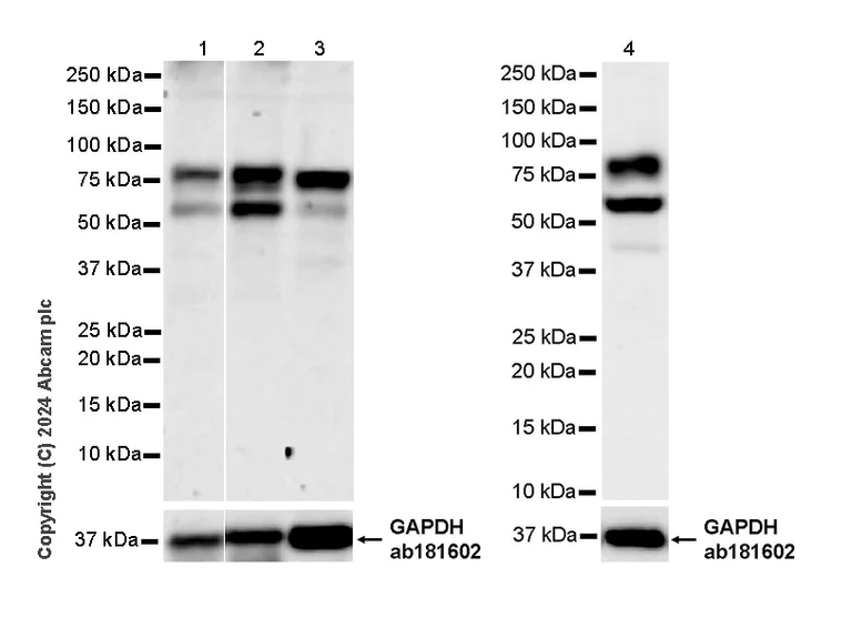 Western blot - Anti-SEMA3B antibody [EPR28920-205] - BSA and Azide free (AB324837)