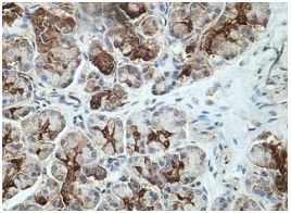 Immunohistochemistry (Formalin/PFA-fixed paraffin-embedded sections) - Anti-SEMA3G antibody (AB197108)