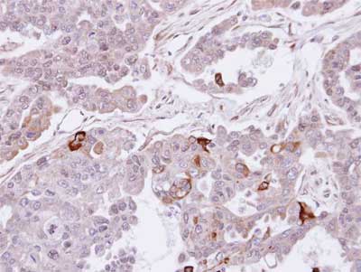 Immunohistochemistry (Formalin/PFA-fixed paraffin-embedded sections) - Anti-SEMA4A antibody (AB155192), expandable thumbnail