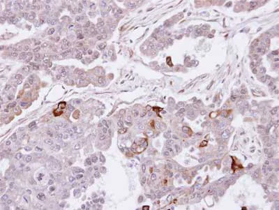 Immunohistochemistry (Formalin/PFA-fixed paraffin-embedded sections) - Anti-SEMA4A antibody (AB155192)