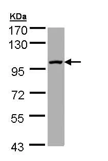 Western blot - Anti-SEMA4A antibody (AB155192)