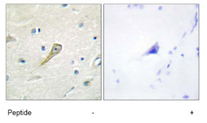 Immunohistochemistry (Formalin/PFA-fixed paraffin-embedded sections) - Anti-SEMA4A antibody (AB70178)