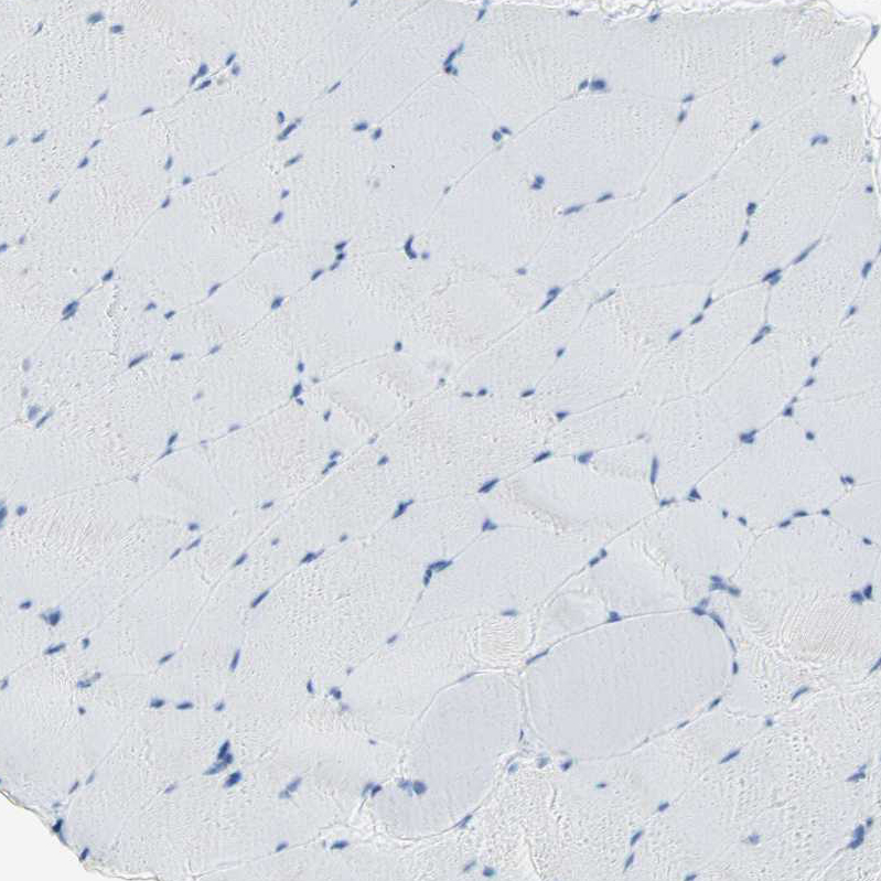 Immunohistochemistry (Formalin/PFA-fixed paraffin-embedded sections) - Anti-SEMA4C/SEMAI antibody (AB121334)