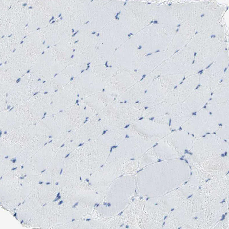 Immunohistochemistry (Formalin/PFA-fixed paraffin-embedded sections) - Anti-SEMA4C/SEMAI antibody (AB121334)