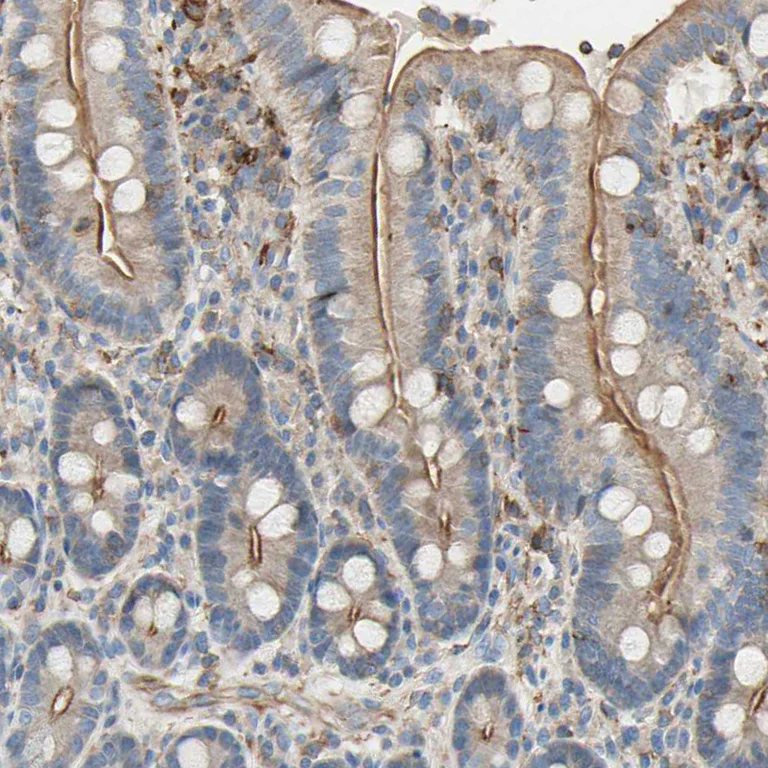 Immunohistochemistry (Formalin/PFA-fixed paraffin-embedded sections) - Anti-SEMA4C/SEMAI antibody (AB121334)