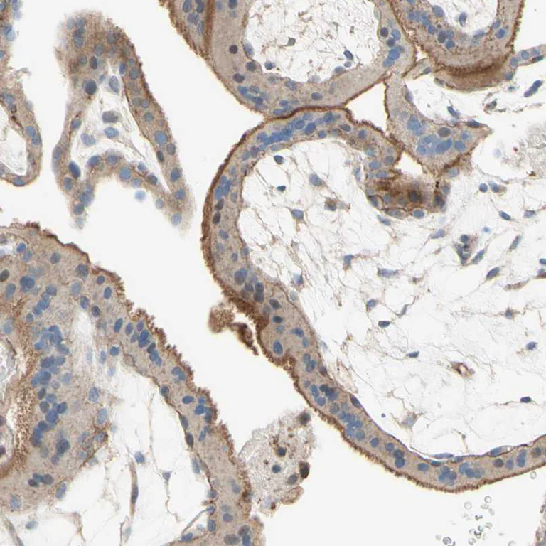 Immunohistochemistry (Formalin/PFA-fixed paraffin-embedded sections) - Anti-SEMA4C/SEMAI antibody (AB121334)