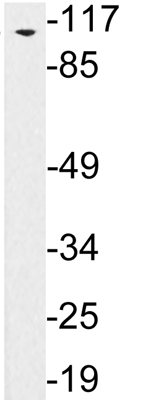 Western blot - Anti-SEMA4C/SEMAI antibody (AB135856)