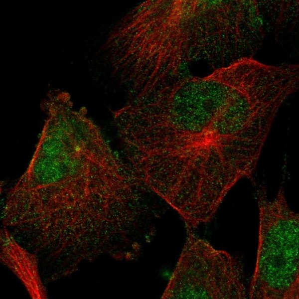 Immunocytochemistry/ Immunofluorescence - Anti-SEMA4F antibody (AB221620), expandable thumbnail