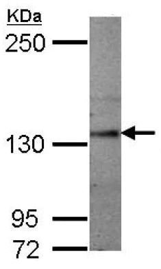 Western blot - Anti-SEMA5A antibody (AB127002)