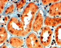 Immunohistochemistry (Formalin/PFA-fixed paraffin-embedded sections) - Anti-SEMA5A antibody (AB51957)