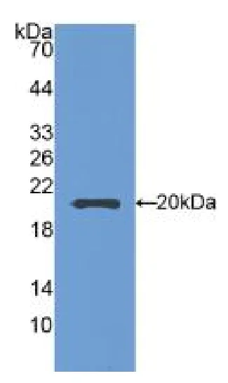 Western blot - Anti-SEMA5B antibody (AB231202)